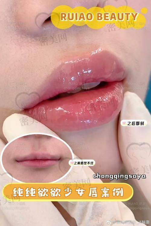 潘柏林医生荣誉资质: