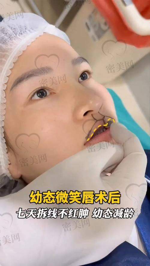 石家庄美联臣：唇部整形的梦幻城堡