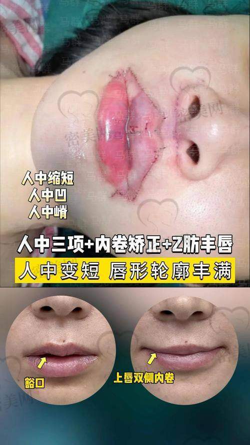 潘柏林医生怎么预约挂号?