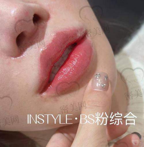 潘柏林医生口碑怎么样?