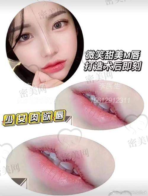 潘柏林医生擅长项目: