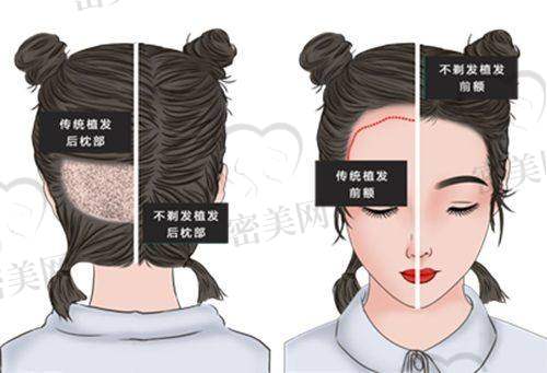 【刘兰芳医生口碑】