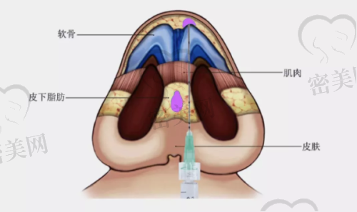 【潘艳妮医生擅长项目】