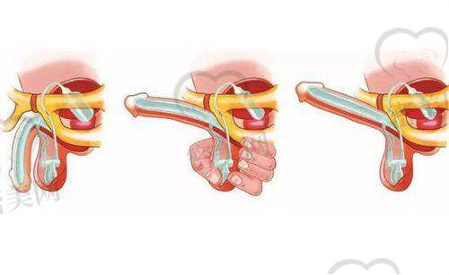 【潘艳妮医生怎么预约挂号？】