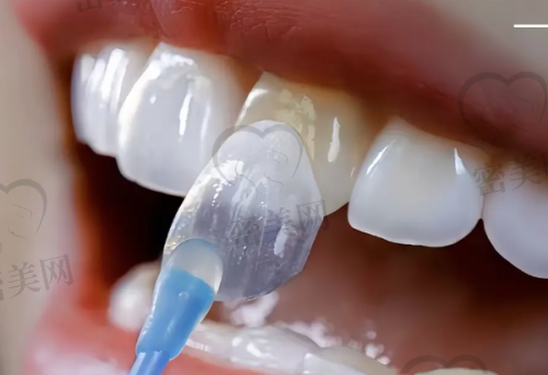 【张家口经开悦己口腔诊所怎么预约挂号?】