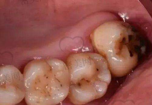 【 阳城小苹果口腔门诊部患者口碑评价：】