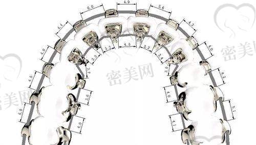 对比看看：MRC不同类型的价格范围