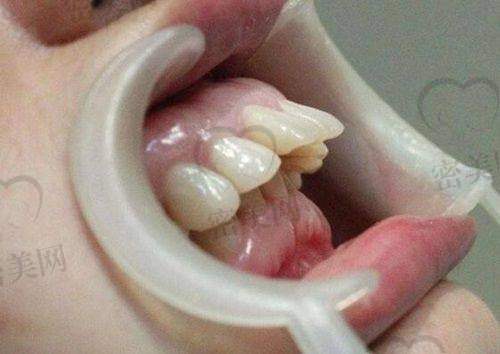 盐城双宝口腔医院环境怎样？看牙体验感好不好？