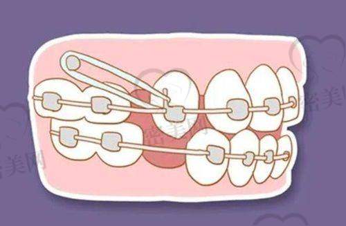 【   阳城小苹果口腔门诊部诊疗设备：】
