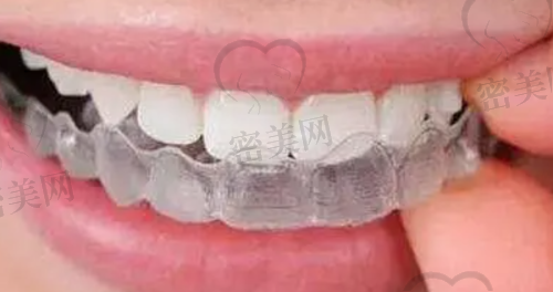 【长治屯留小苹果口腔门诊部是正规的吗?】