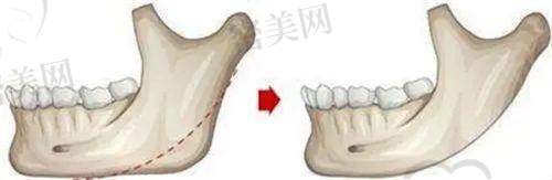【万海燕医生口碑怎么样？】