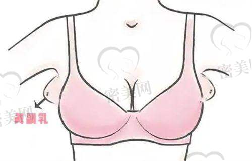 【刘智瑰医生擅长项目】