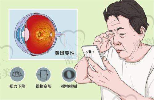 重庆千叶眼科医院近视/白内障项目价格一览
