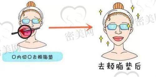 医院热门项目有哪些?真实价格+术后成效整理