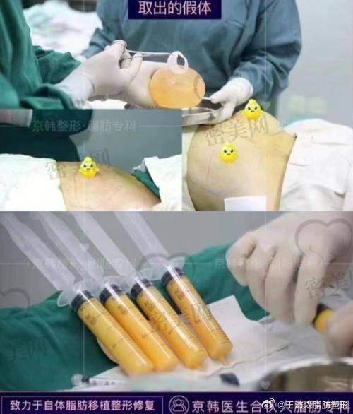各系列优势分析