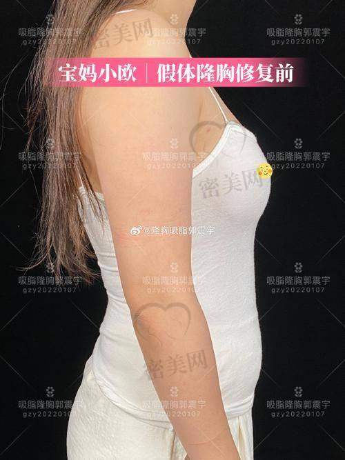 怎么选？你的需求决定你选哪款