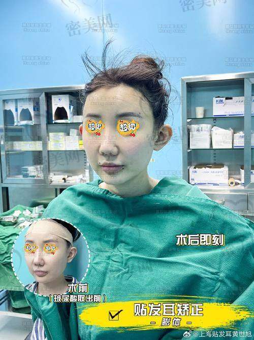 高玉伟医生：耳部整形界的“魔法大师”