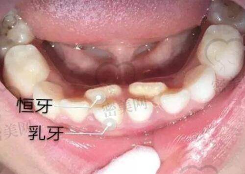 中山大学附属第一医院整形外科 医师——李晓慧