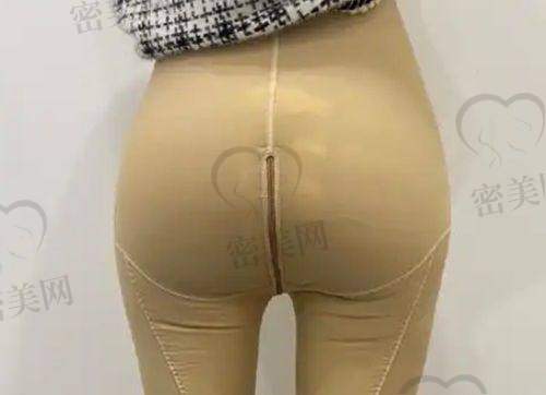 隆胸项目