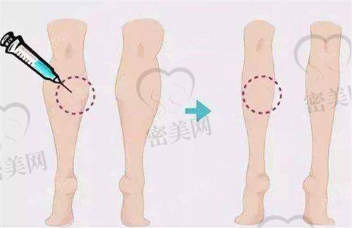 面部整形项目