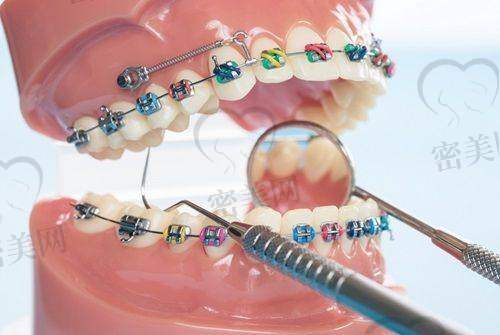 大同精典口腔万达分院怎么预约挂号?