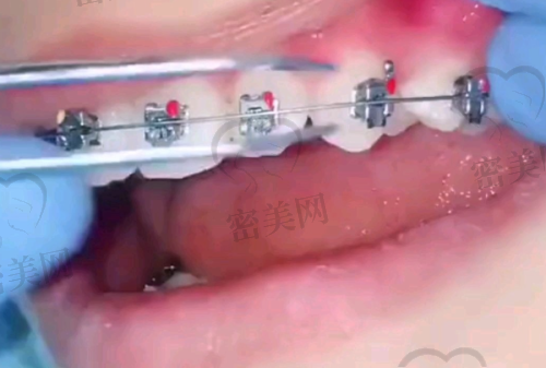 大同精典口腔万达分院营业时间: