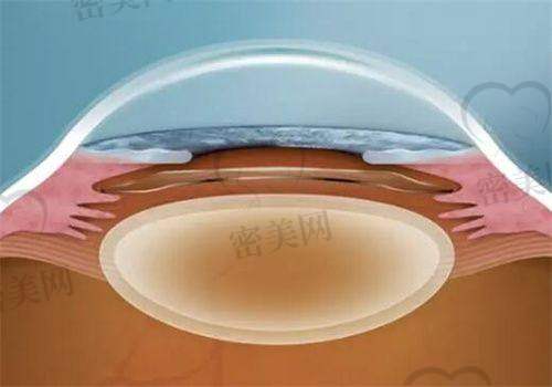 深圳普瑞眼科医院口碑怎么样？