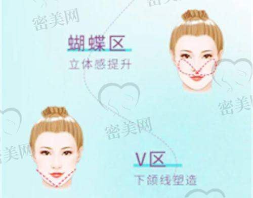 百佳玛丽亚私密整形怎么样?产后修复适配性强,术后修复快