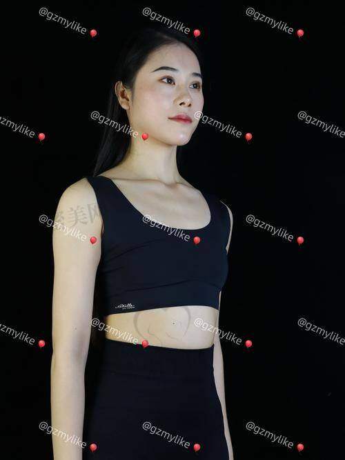 如何选择适合自己的傲诺拉假体型号