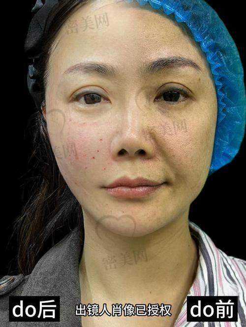 吴贞跃医生（上海嘉漾医疗美容）：专注“减法美学”，适合优质感路线用户