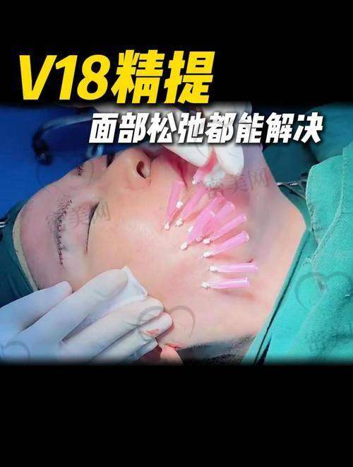张本军 医生（安禾美阁医美门诊部）：微创修复高性价比，适合预算有限者
