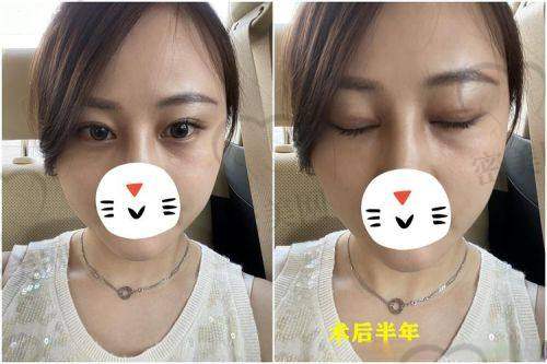 郭东超医生：13800 元背后的不错医术与独特优势