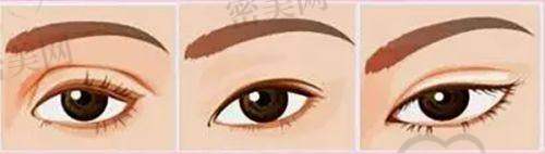 南京新时代医疗美容医院：五维打造精致眼
