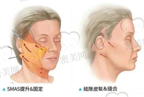 永州铂丽医疗美容门诊部口碑怎么样?