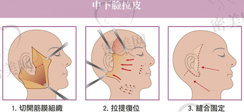 张洲医生技术特点：
