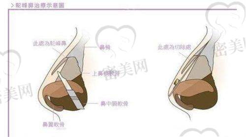 中部战区总医院整形外科是正规的吗？