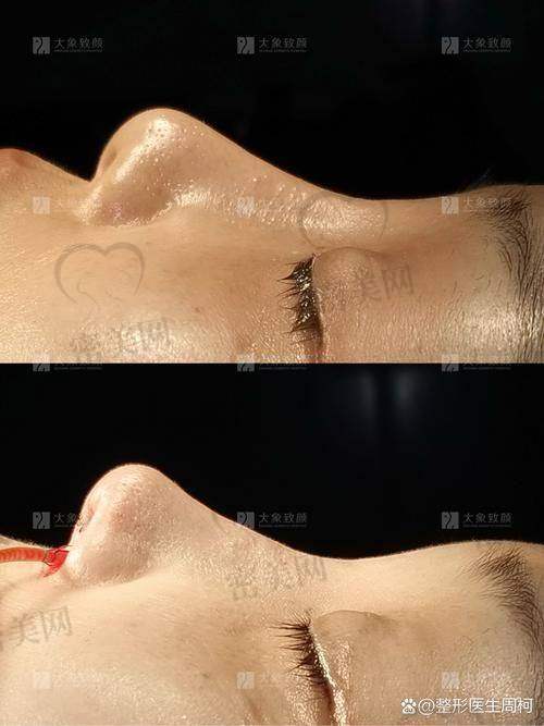 戴传昌医生口碑怎么样？