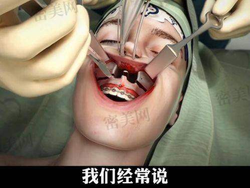 哪些人适合找薛国初医生进行正颌手术？适应症范围广泛