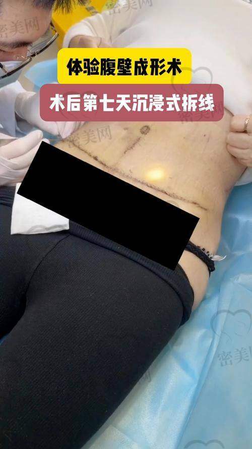 术后护理不到位，可能比手术还贵！这里有你必须知道的修复知识