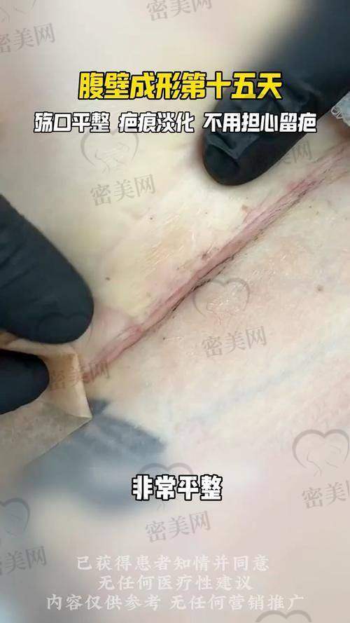 高性价比不只是看价格：四川现代整形医院细节服务与优惠说明
