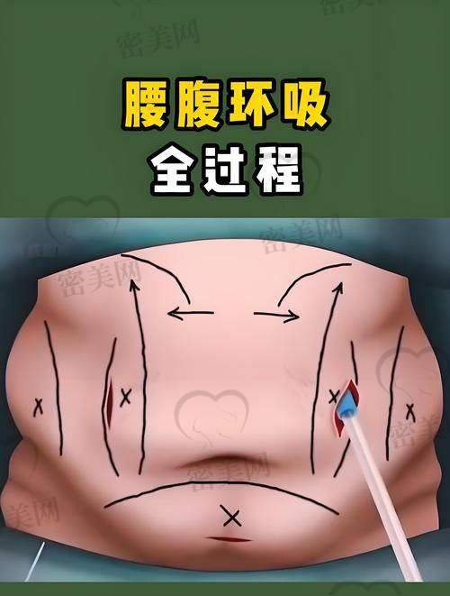 张航医生——实力搅局者，带来功能性+外形双赢新方向