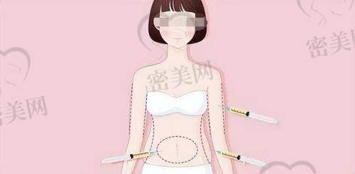 石家庄美联臣：吸脂塑形的“梦幻城堡”