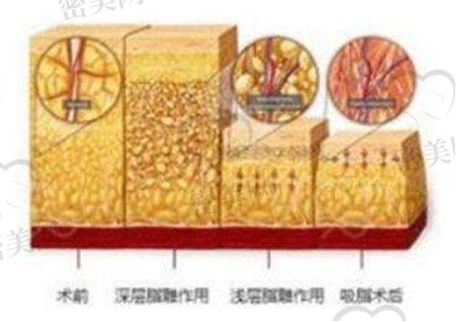 合肥梵蜜医美整形：术后护理做得细致