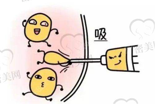 高玉伟医生：吸脂塑形界的“魔法大师”
