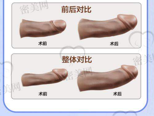 核心医生团队实力解析——李响/曹经栋/丛相文