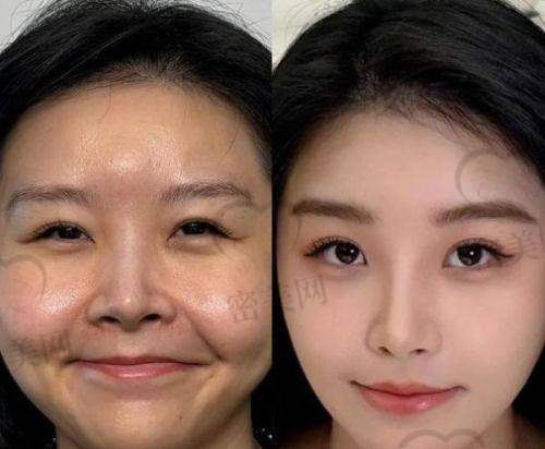 衡阳爱思特医疗美容医院怎么样？