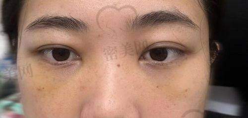 厦门伊婉整形外科