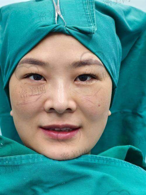 黄军伟医生术后服务如何？在郑州属名列前茅水平