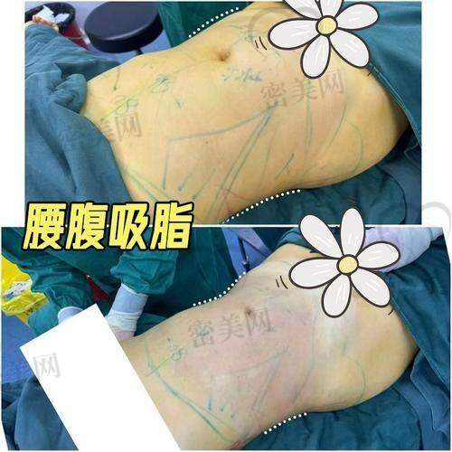 温莎医疗美容整形医院