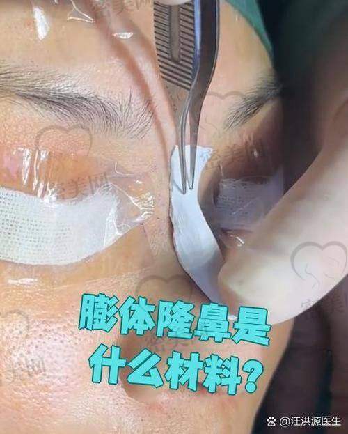 术后修复的小插曲与大惊喜